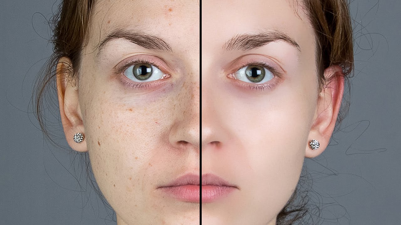 Photoshop-Smooth-Skin-and-Remove-Blemishes-Scars